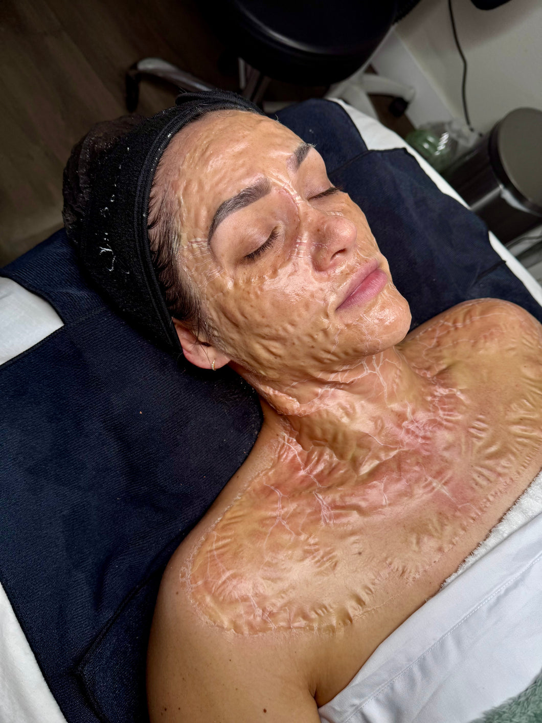 DMK Enzyme Treatment  (regular price $300)